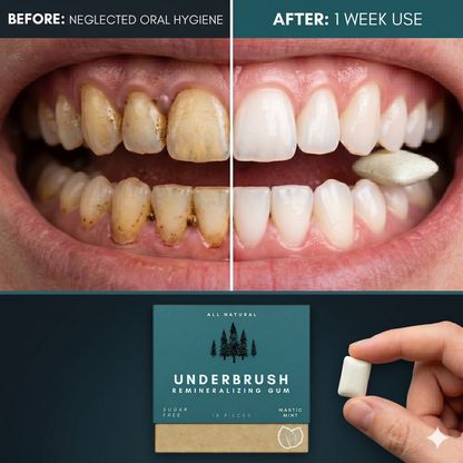 Remineralizing Gum