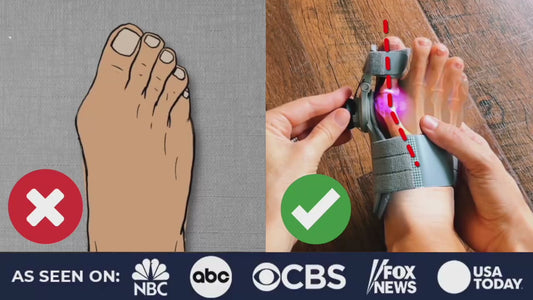 👣 Bunion Brace Corrector – Walk Without Pain