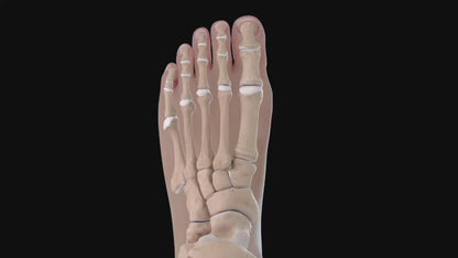 👣 Bunion Brace Corrector – Walk Without Pain